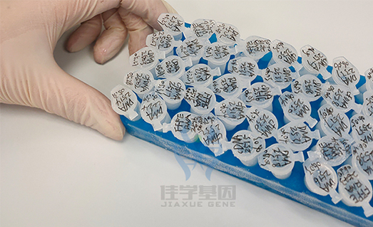 【佳学基因案例】癫痫基因检测、基因解码